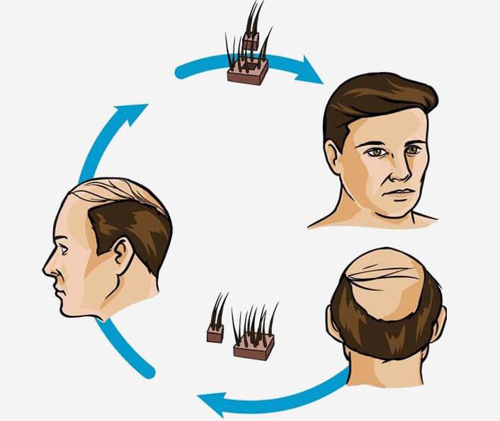 hair transplant advances history houston texas