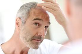 Benefits of Hair Restoration In Houston