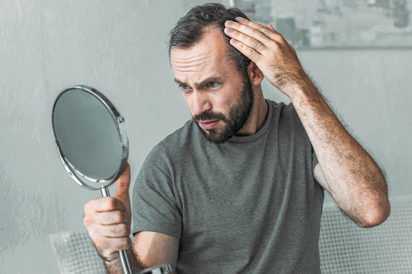 hair loss treatment