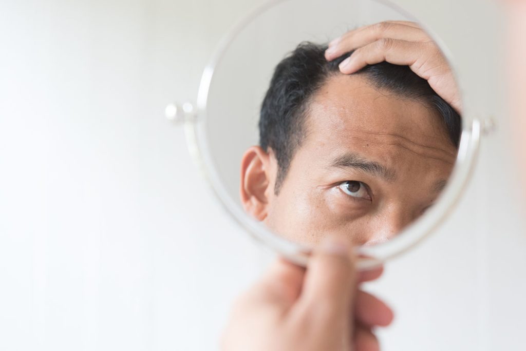 See a Doctor For a Hair Transplant Consultation