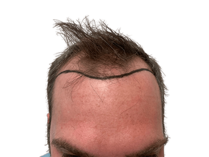 Male Enhancement Gummies That Actually Work: A Comprehensive Guide (iLloj)